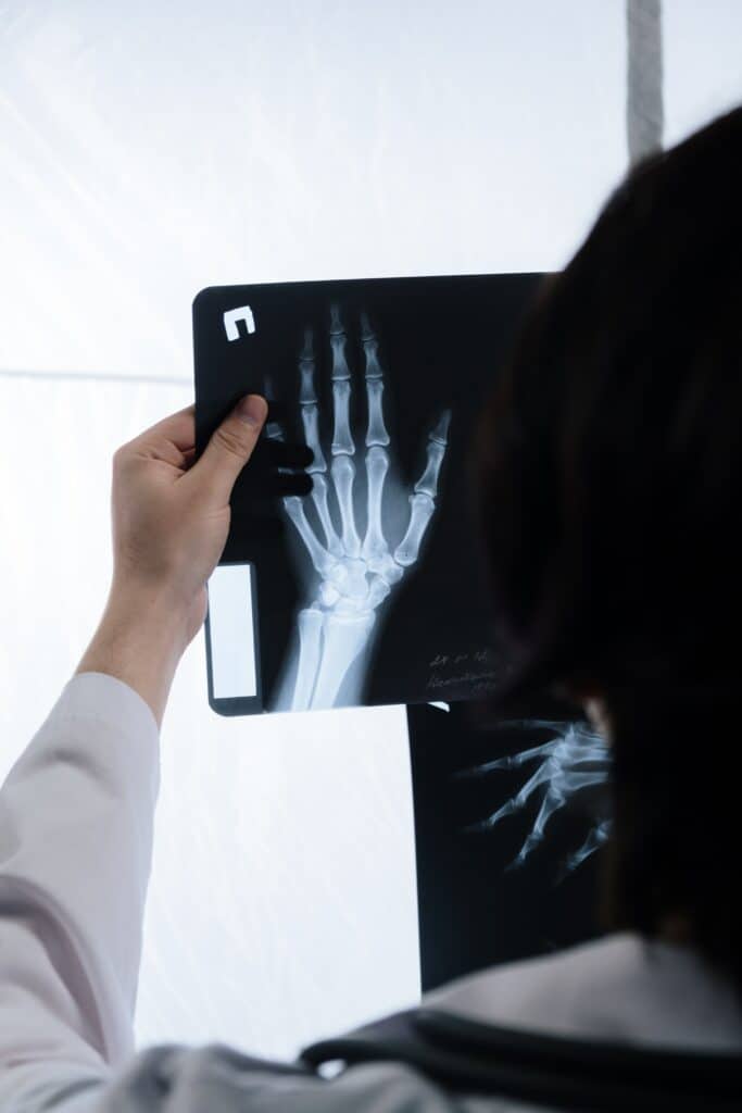 A doctor is examining an x - ray of a patient's hand.